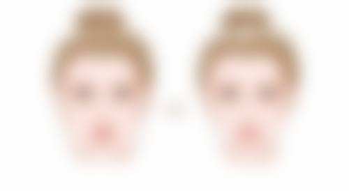 什么时候隆胸比较好——更年期女性：抓住激素变化的末尾窗口期