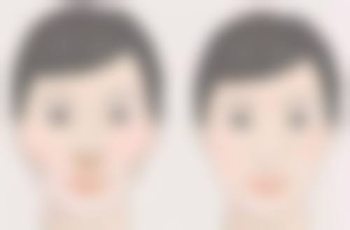 儿童与成人祛痣疤痕修复时间对比