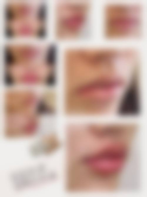 深圳明伦门诊部医疗美容科怎么样，更擅长什么