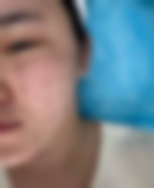 厦门思明碧莲盛医疗美容诊所怎么样，可靠吗