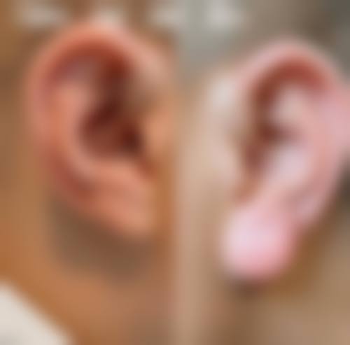 深圳明伦门诊部医疗美容科怎么样，顾客实例情况