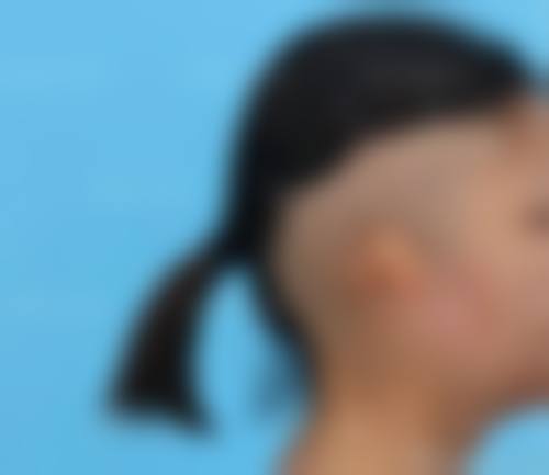 陈绍周医生简介做手术价格