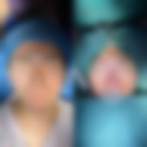 北京英凰整形医院价格表