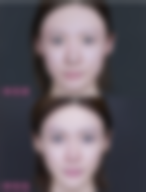 【黑金超光子嫩肤套餐+2000】湖南省妇幼保健院医生实力怎样