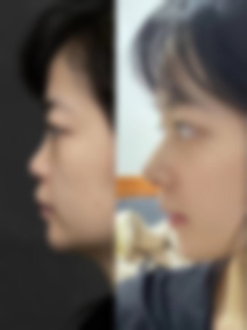 智淑平医生项目优势