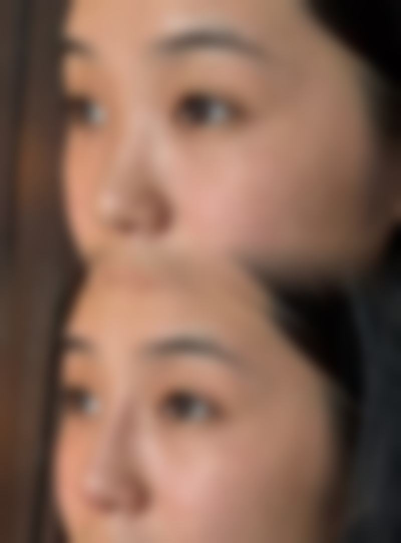 什么时候隆胸比较好——产后妈妈：哺乳结束6个月后的重生时刻