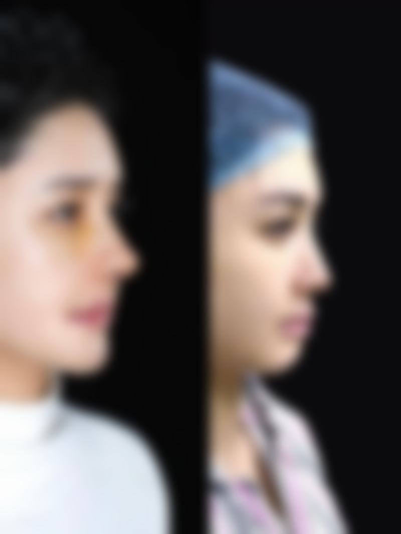 青岛瑧妍美医疗美容医院张为宝价格性价比真实评价