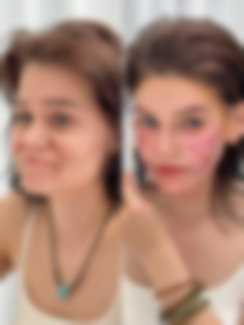 如何延长隆鼻成效的寿命：精心呵护美丽