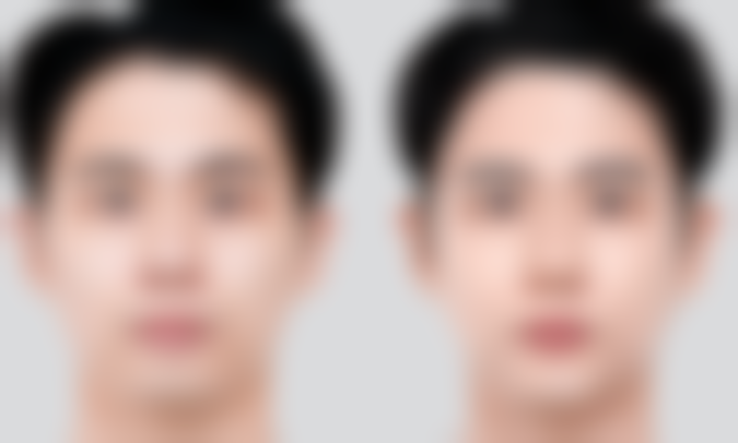 郑州妍琳医疗美容门诊部顾客实例