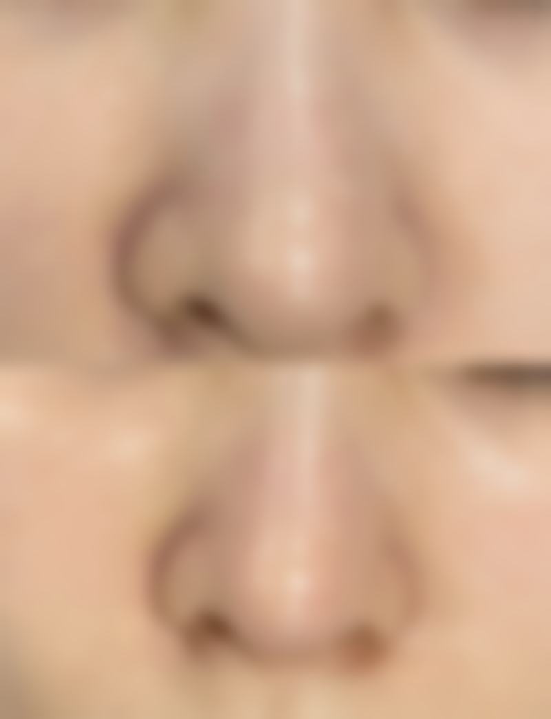 合资隆胸假体有哪些？蜜桃、芮尔等5大合资品牌安全与自然度测评