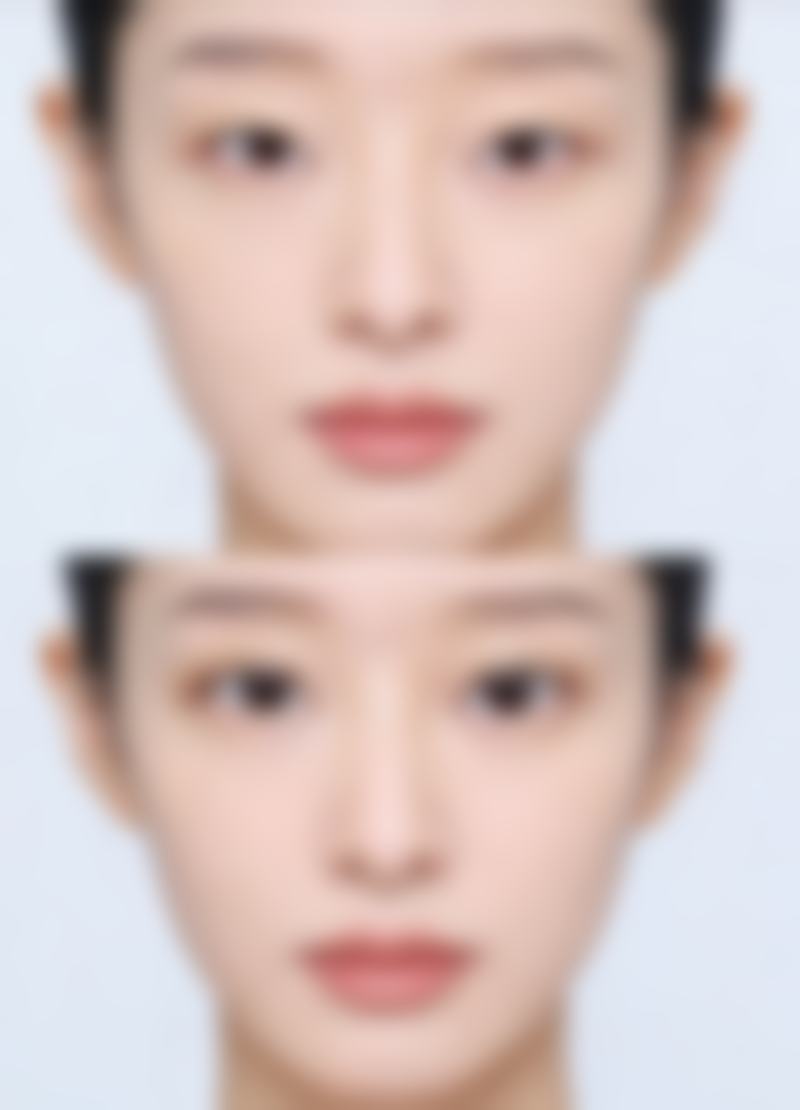 尾段:耐心护理,早日拥有光滑肌肤