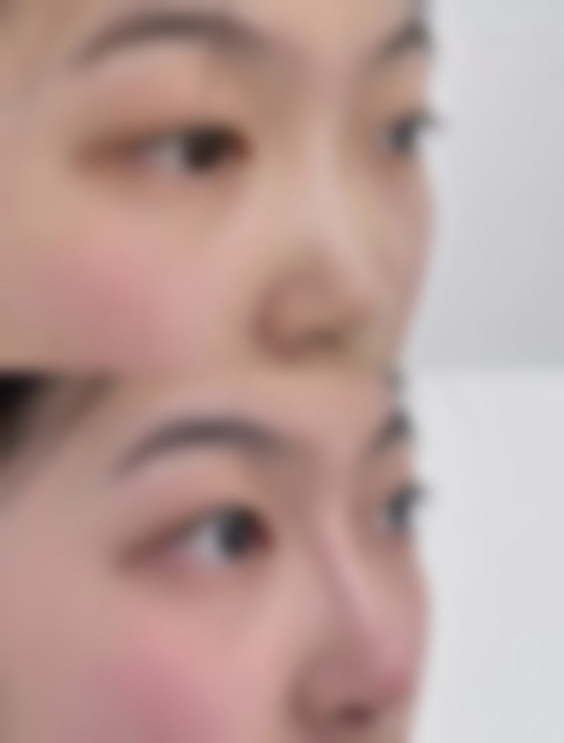 宝鸡然美汐整形医院项目特色