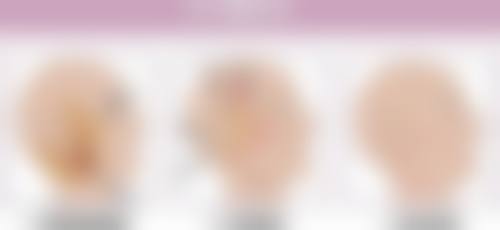 疤痕性青春痘如何治疗：精细激光匹配个性痘疤