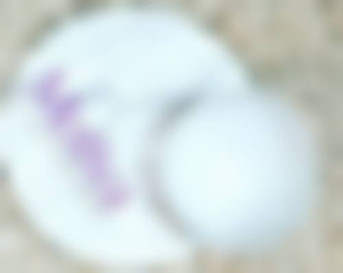 做抽脂手术多久可以修复：塑身衣的关键作用