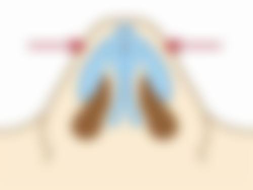 上海蝶可变整形医疗美容门诊部更擅长什么