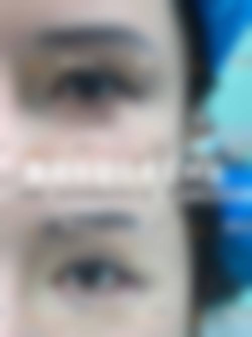 石家庄雅馨天成整形医疗美容诊所怎么样，更擅长什么手术