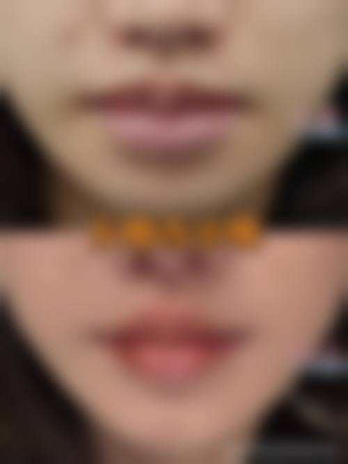 连云港美缔整形美容诊所科室特色项目