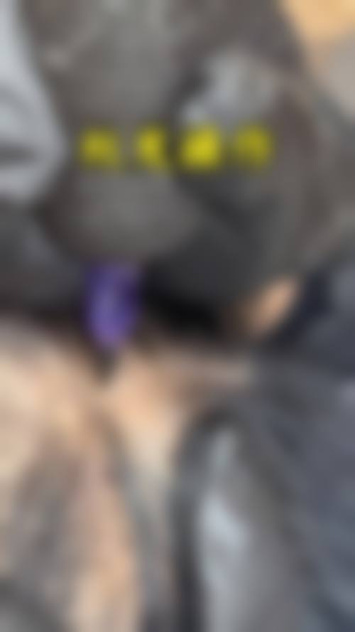 沈阳牛大夫植发医院口碑好不好?附真实患者口碑评价