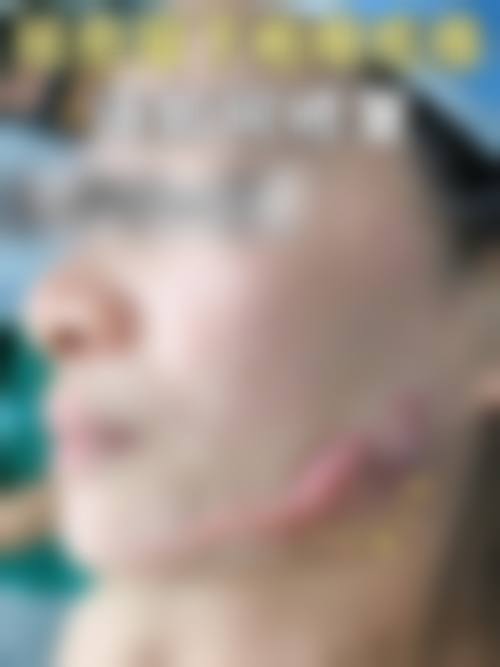 四、韩国BeautyBar整形外科正规吗