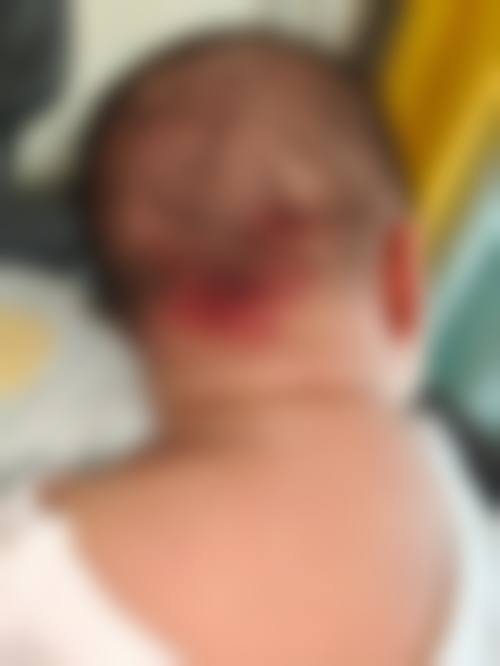 广州卓智医疗美容门诊部顾客实例