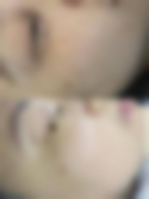 长春榆树陈伟整形医疗美容诊所怎么样，更擅长什么