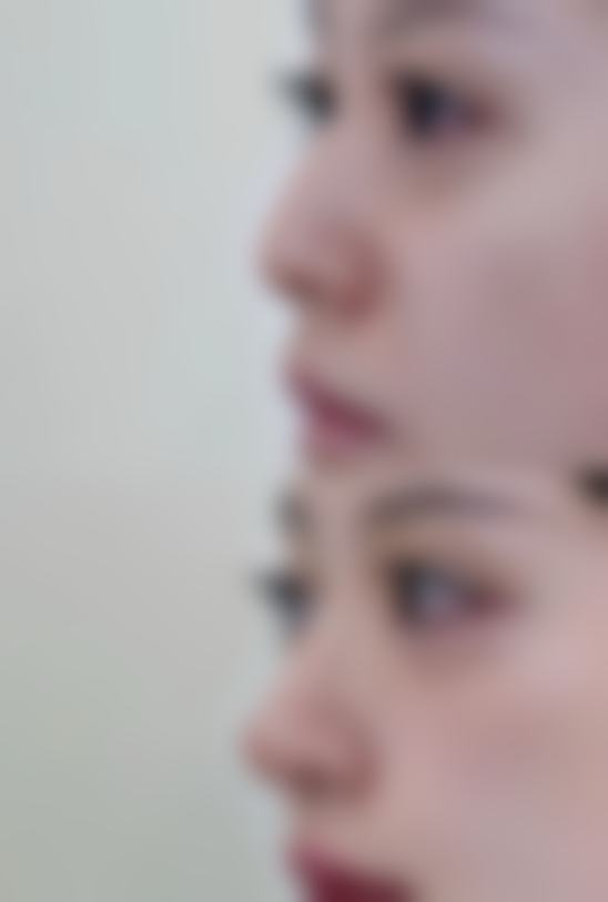 韩国奥来整形外科医院怎么样，口碑评价如何？