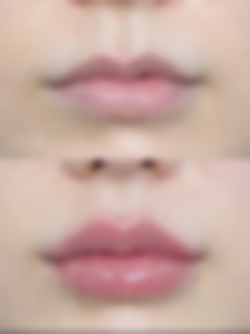 易胜医生重度脑创伤救治口碑情况