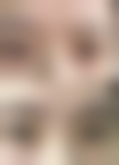 疤痕性青春痘如何治疗：中医调理打造天然“修护堡垒”