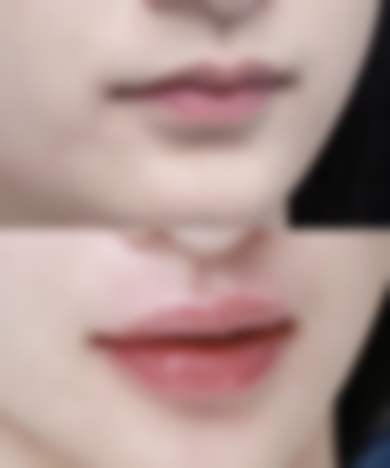 抽脂医院选择:正规医院 vs 小诊所生死差异