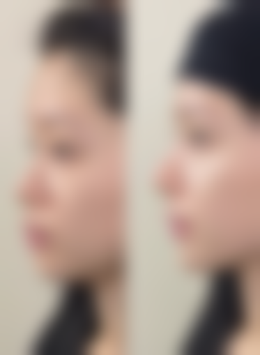 广东佛山顺德东方医院怎么样，口碑评价如何