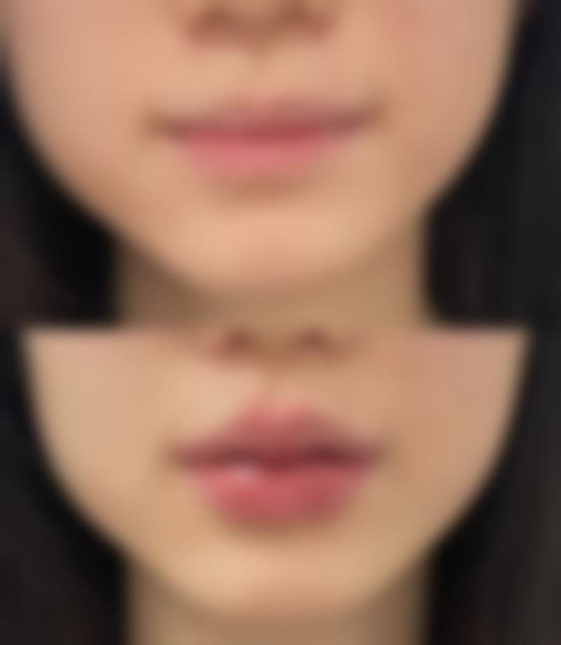 崔林医生顾客实例图片