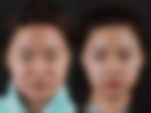 鄂尔多斯华韩医疗美容医院口碑好不好?附真实患者口碑评价