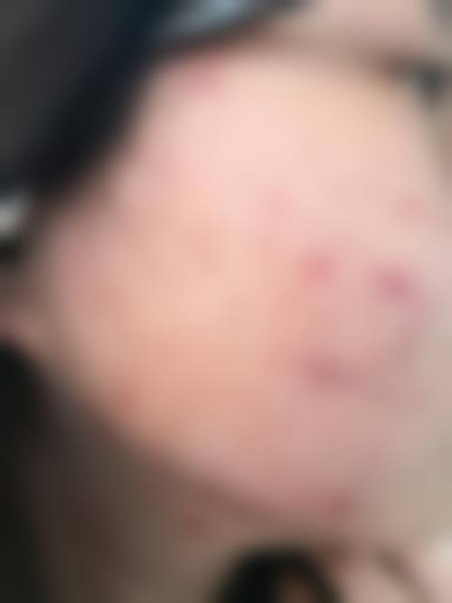 合肥红妆整形美容医院价格表