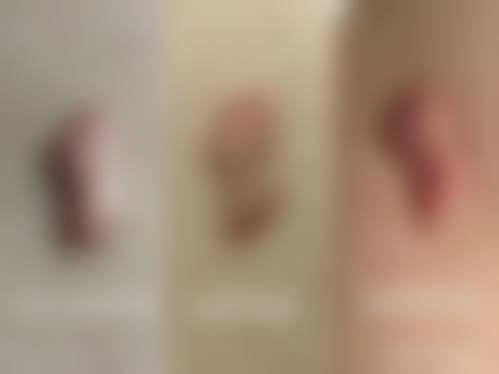 海口云希医疗美容诊所怎么样：评价