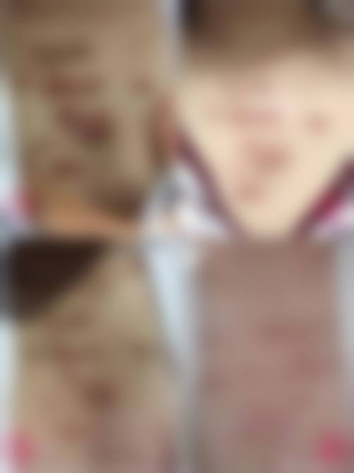 沧州美神唤美整形医院口碑好不好:真实患者评价佳