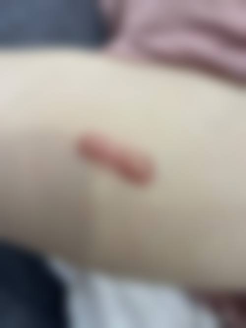 韩国德希尔THE HEAL皮肤科口碑评价