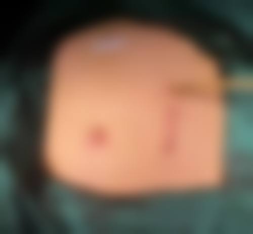 郑州丽天整形医院口碑好不好?附真实患者口碑评价