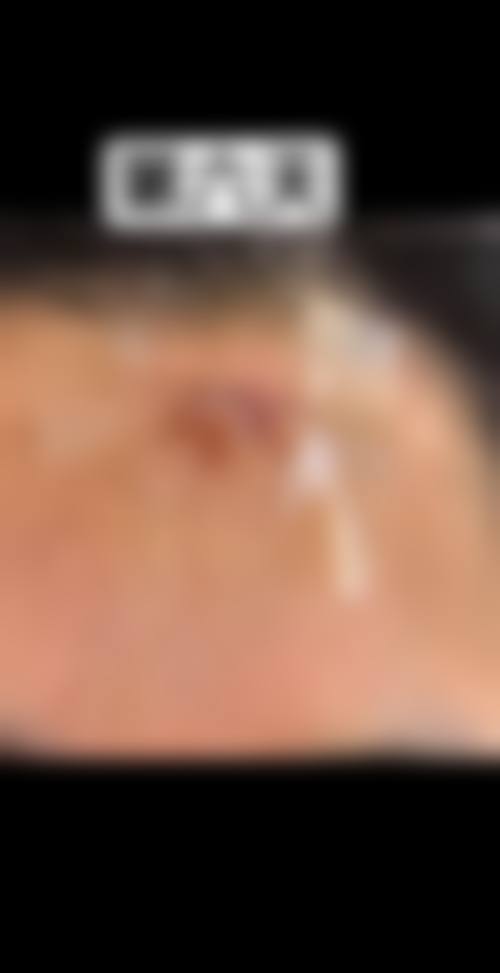 兰州陈晨中医针灸整形美容诊所怎么样,可靠吗