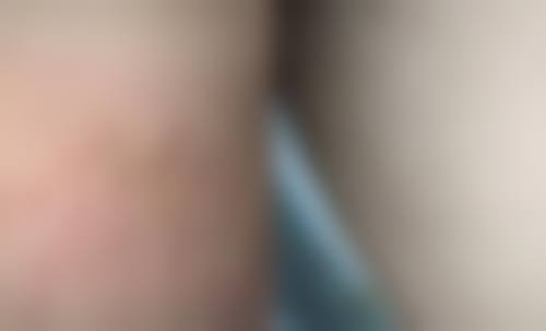 日本Femmy（フェミー）美容皮肤科医院项目特色