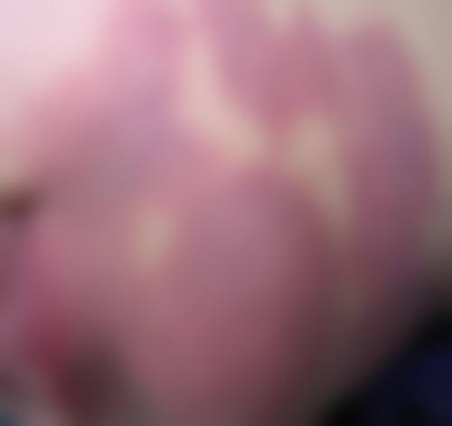 银川崔大夫博士丽医疗美容门诊部特色项目有哪些