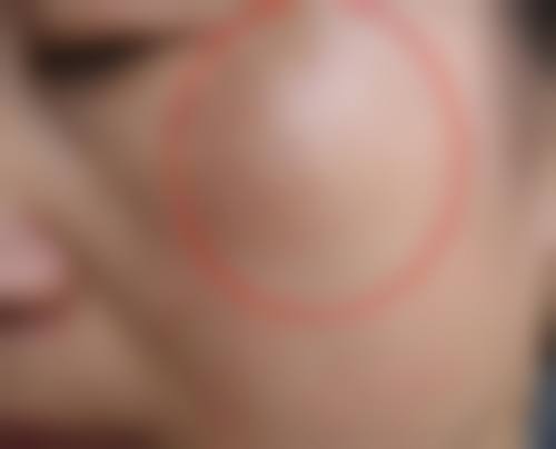 北京延世整形医疗美容抖音团购活动及价格表