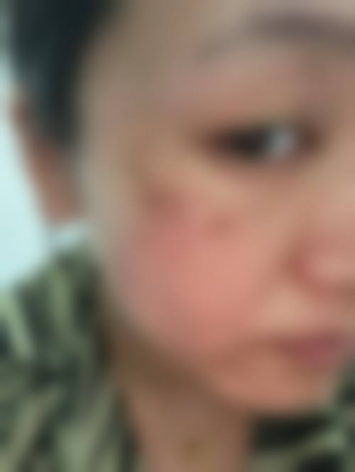 东莞奥利维亚整形医院项目特色