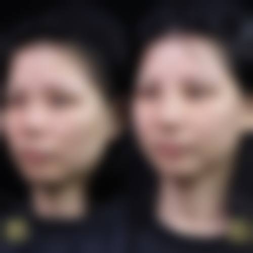 池岳龙医生怎么挂号