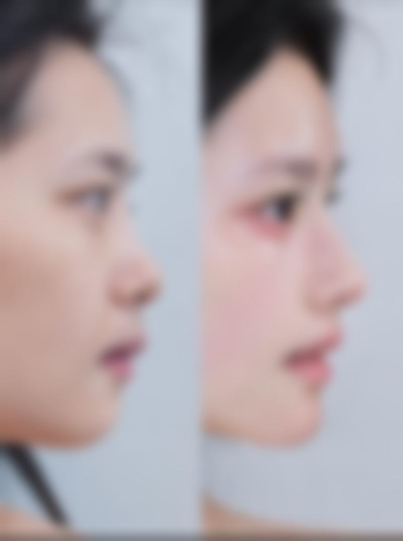 保定京都整形医院项目特色