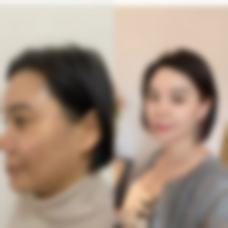 保定世纪协和医院（整形美容科）价格表