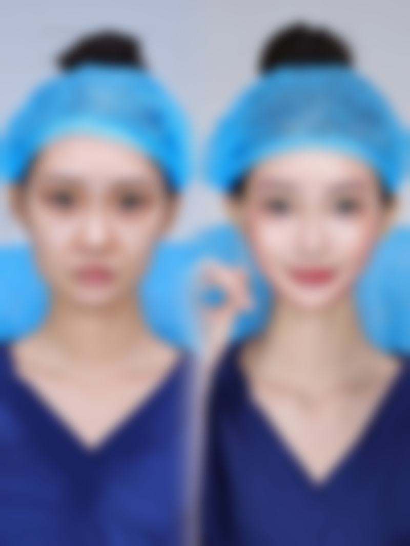 海口云希医疗美容诊所怎么样：价格表