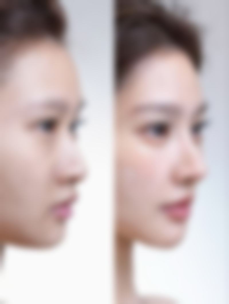 池岳龙医生顾客实例图片