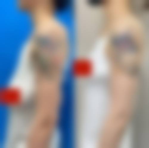 成都永康医院整形美容科口碑评价详情