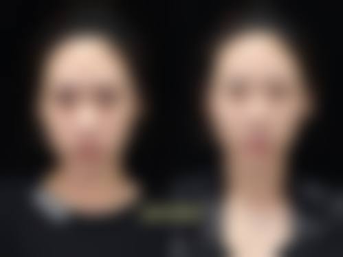 泰安女兵美容整形外科诊所怎么样价格表