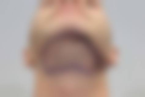 武汉熙朵植发医疗美容门诊部怎么样?有哪些特色项目